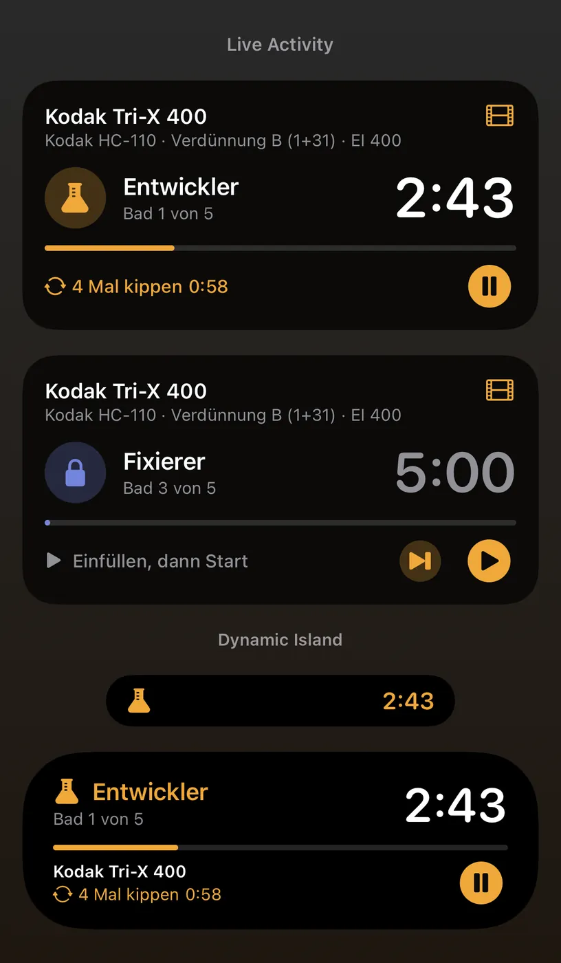Live-Aktivität und Dynamic Island