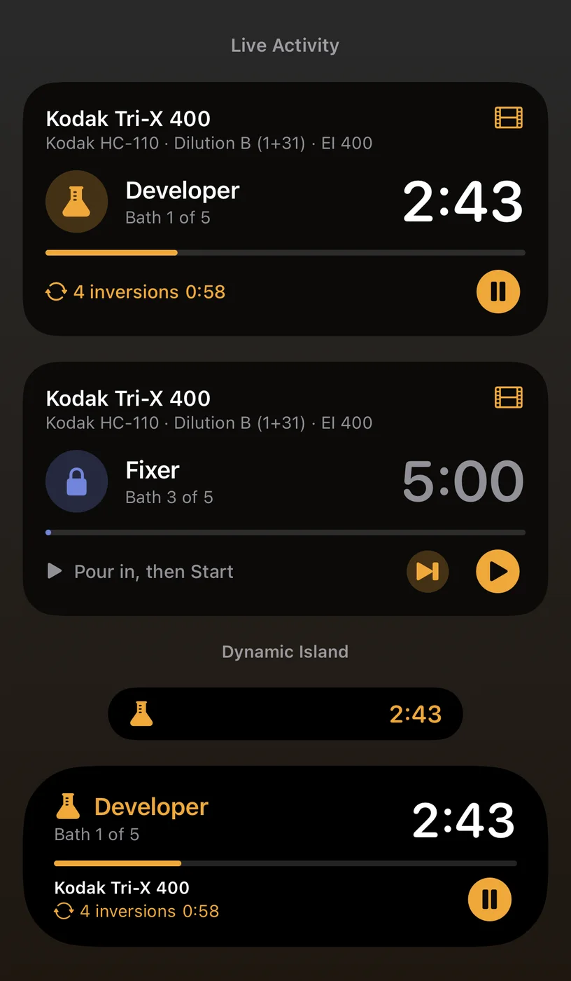 Live Activity and Dynamic Island
